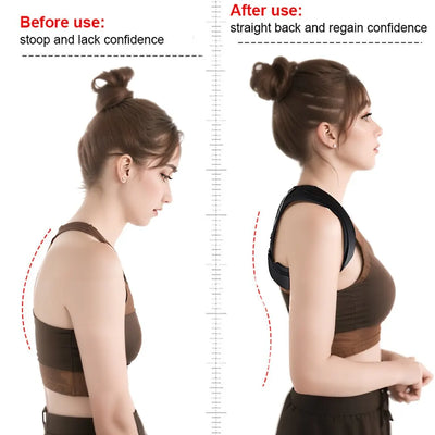 Adjustable Clavicle Support for Neck, Back & Shoulder Pain Relief - Merelux Store